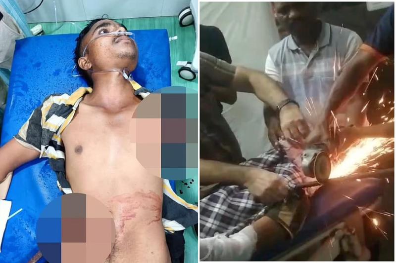【震撼片】工人慘變「鋼鐵人」 遭2長鋼筋刺穿身體!他活下來了